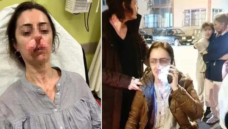 Otomobil Kapısı Silah Olarak Kullanıldı: Şok Eden Olay Detayları