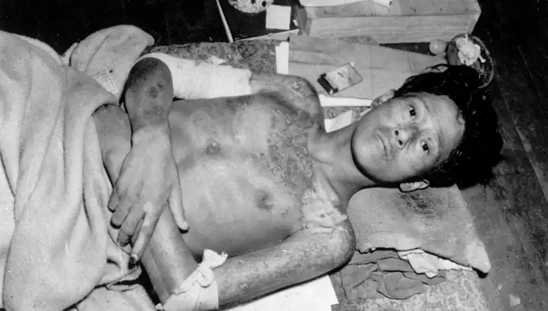 Nagasaki'den Gelen Uyarı: Nükleer Felakete Dikkat!